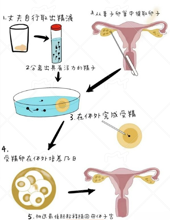 4c7a5531f41e3334a1f86e301edddf5a.png